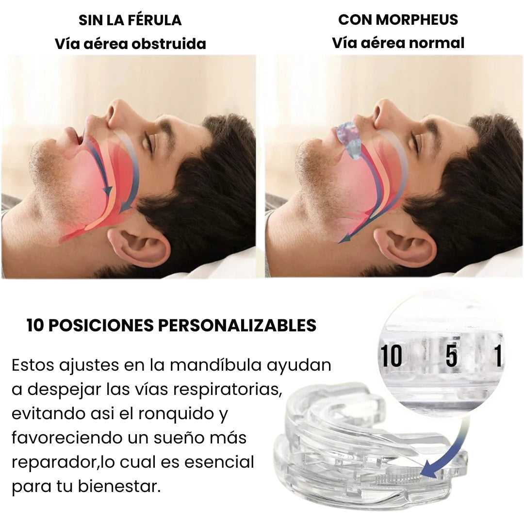 Morpheus – Protector Bucal Antirronquidos y Antibruxismo con Estuche Protector de Regalo