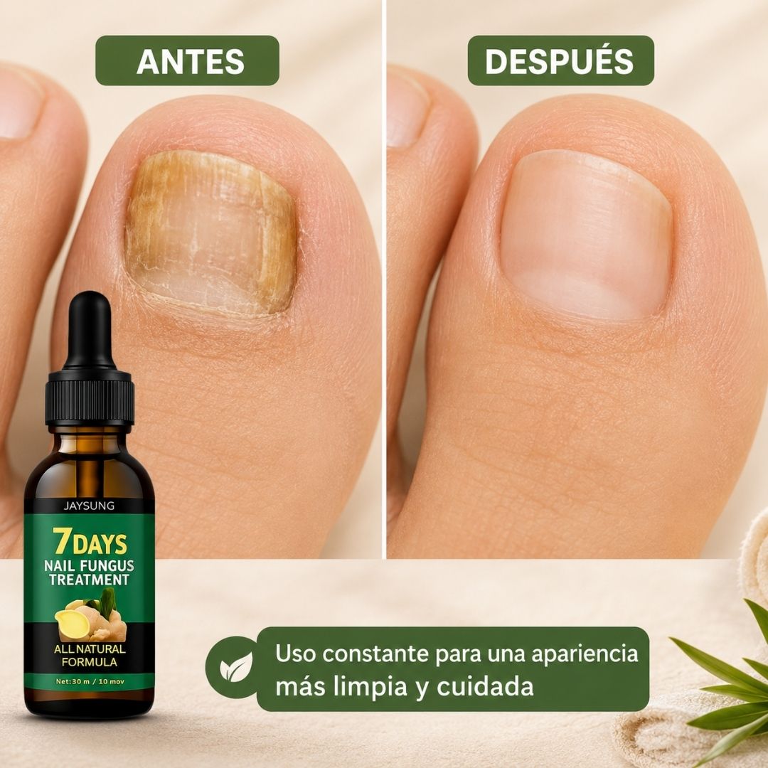 COMBO 2x1 | TRATAMIENTO ANTI HONGOS 7 DÍAS 100% NATURAL